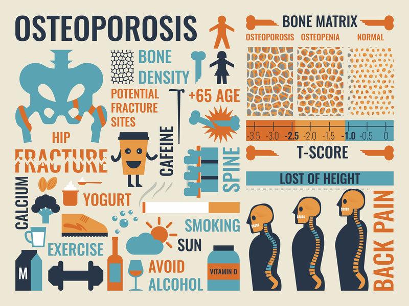 Lifestyle Choices: Building Stronger Bones through Diet and Exercise