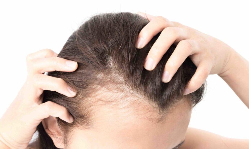 Understanding the Hormonal Impact on Hair Health