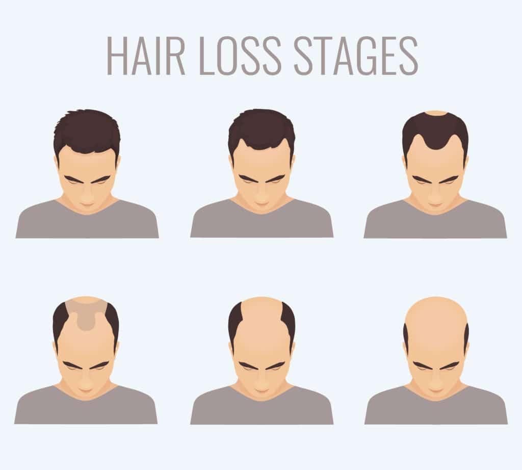 Effective Strategies for Managing Hair Loss and Promoting Health