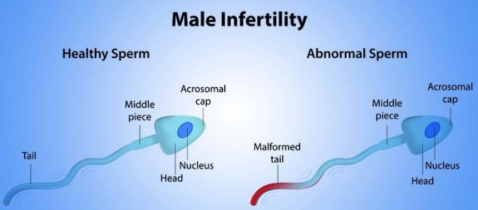 Recognizing Early Signs of Male Infertility